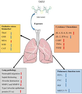 Possible Treatment Approaches of Sulfur Mustard-Induced Lung Disorders, Experimental and Clinical Evidence, an Updated Review